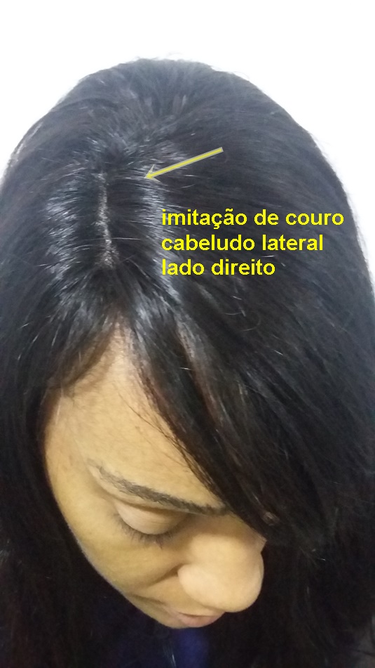 Prótese master molde 14x14 com imitação de couro cabeludo lateral ( lado direito)100 gramas-9859