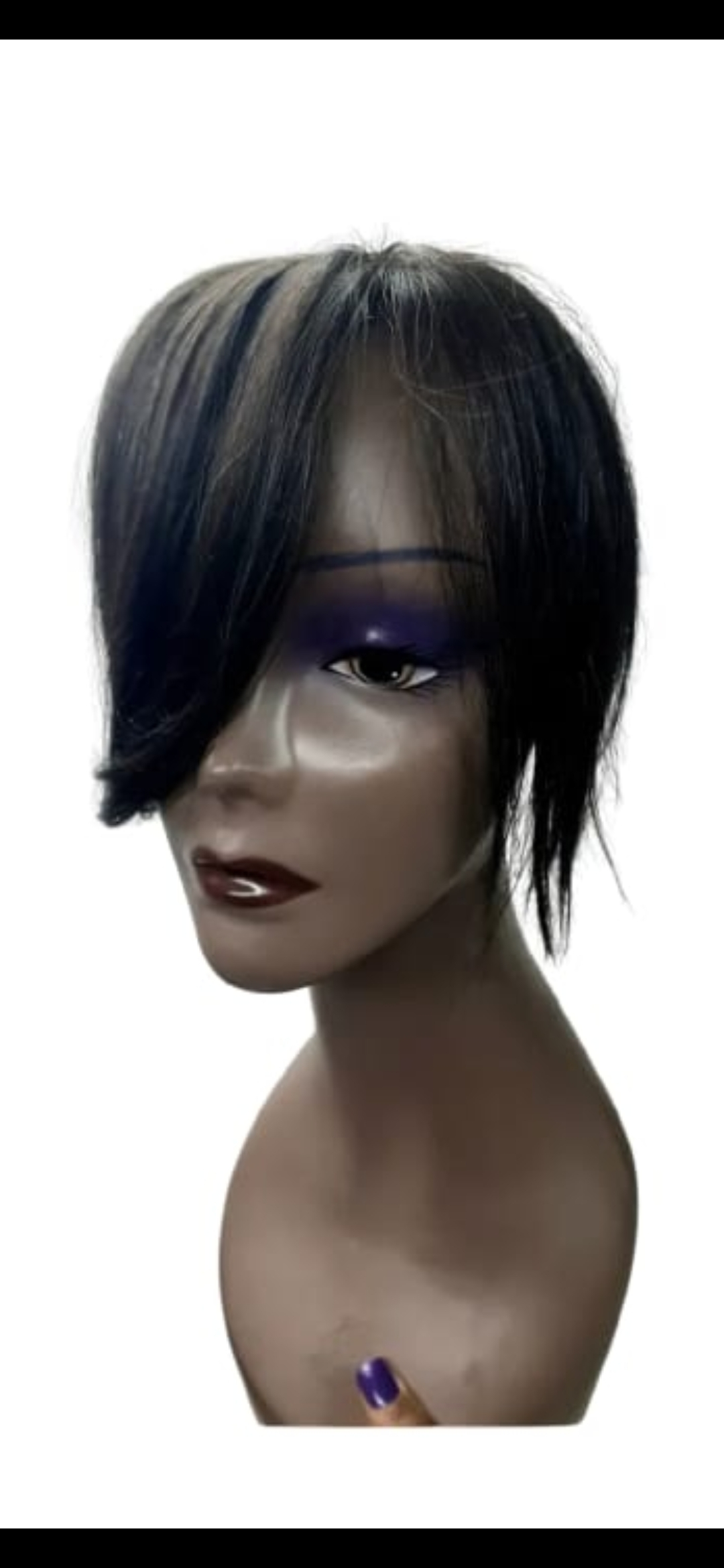 Calvicie feminina